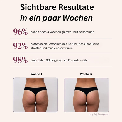 3D Anti-Cellulite Leggings